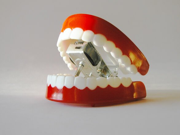 chatter teeth 3 1426223